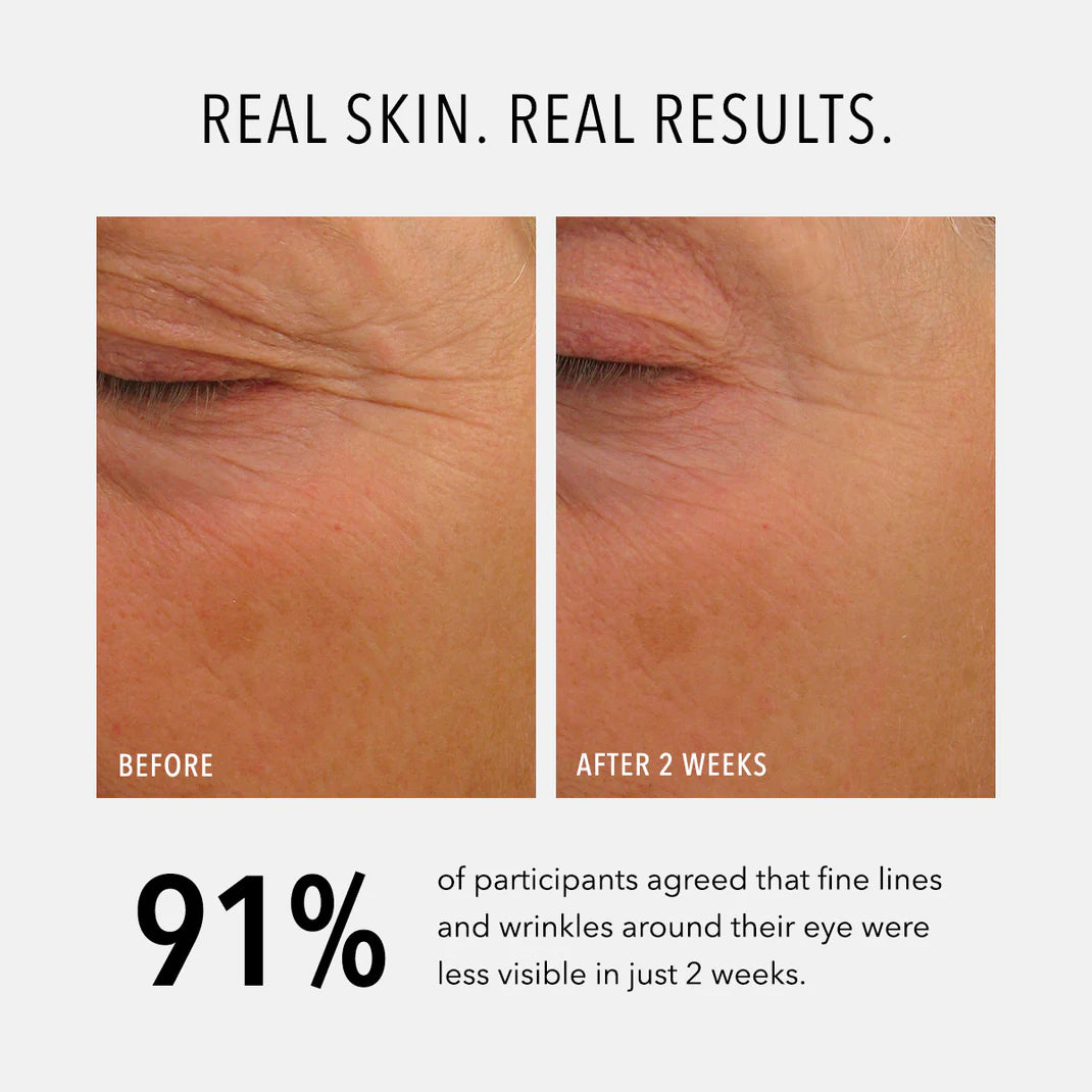 Eye Authority {Dark Circles, Puffiness, Fine Lines}