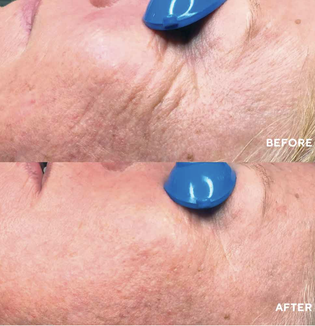 Nimni Cream Patented Collagen Support Complex