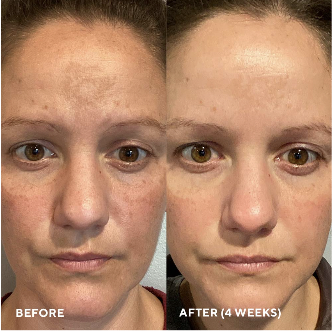 Firma-Bright 20% Vitamin C Booster