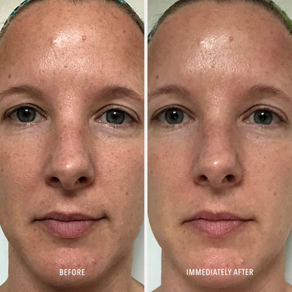Polish &amp; Plump Face Peel {2-Step Microdermabrasion + Peel}