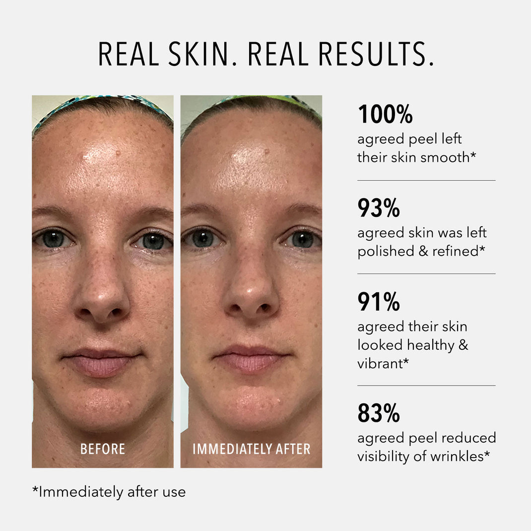 Polish &amp; Plump Face Peel {2-Step Microdermabrasion + Peel}