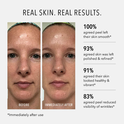 Polish &amp; Plump Face Peel {2-Step Microdermabrasion + Peel}