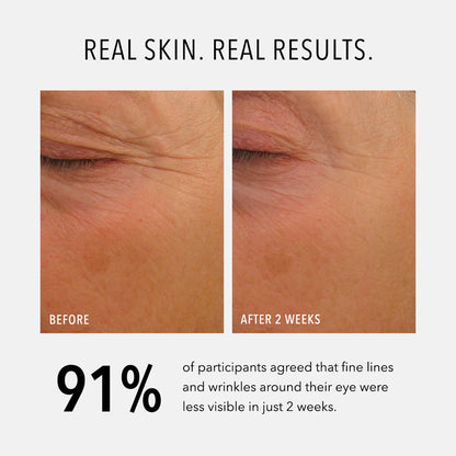 Eye Authority {Dark Circles, Puffiness, Fine Lines}