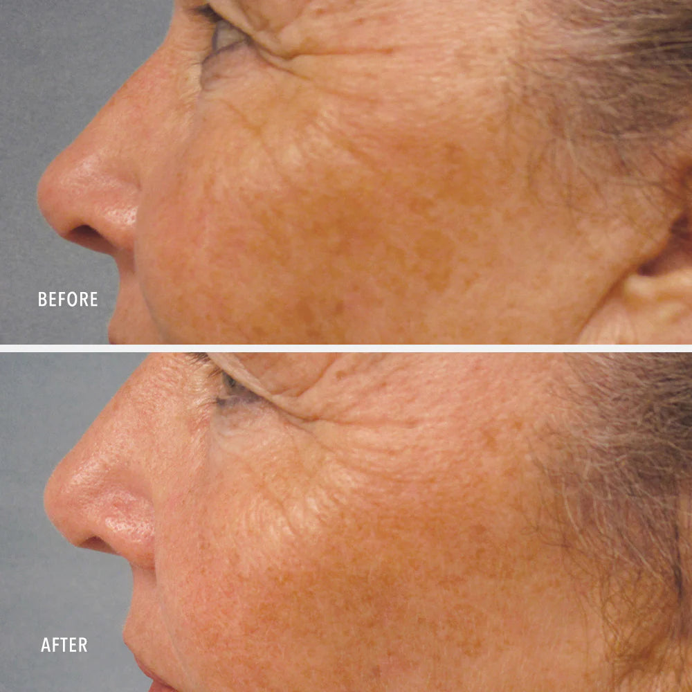 LumaPro-C Serum, Skin Brightening Pigment Corrector