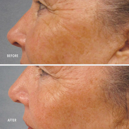 LumaPro-C Serum, Skin Brightening Pigment Corrector