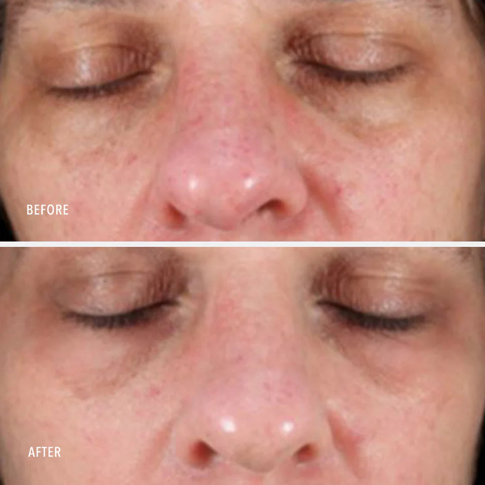 Collagen Reactivate PM