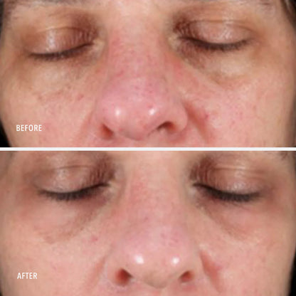 Collagen Reactivate PM