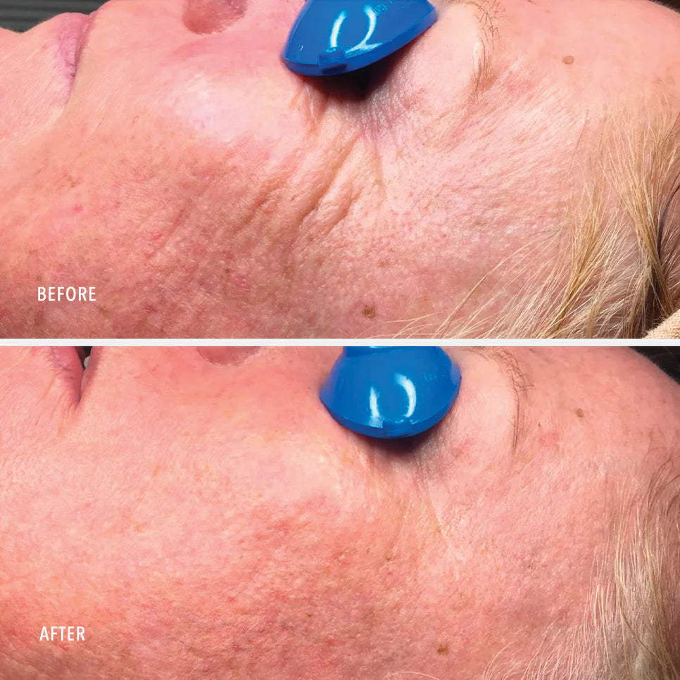 Collagen Reactivate PM