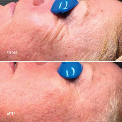 Collagen Reactivate PM