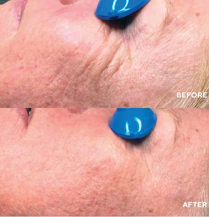 Nimni Cream Patented Collagen Support Complex