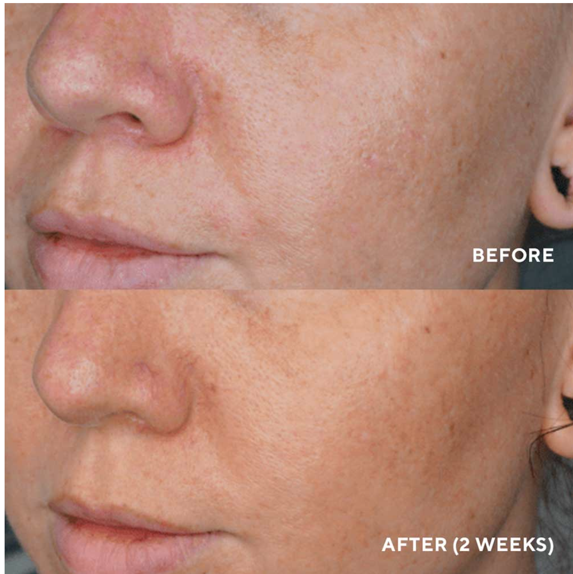 LumaPro-C Serum, Skin Brightening Pigment Corrector