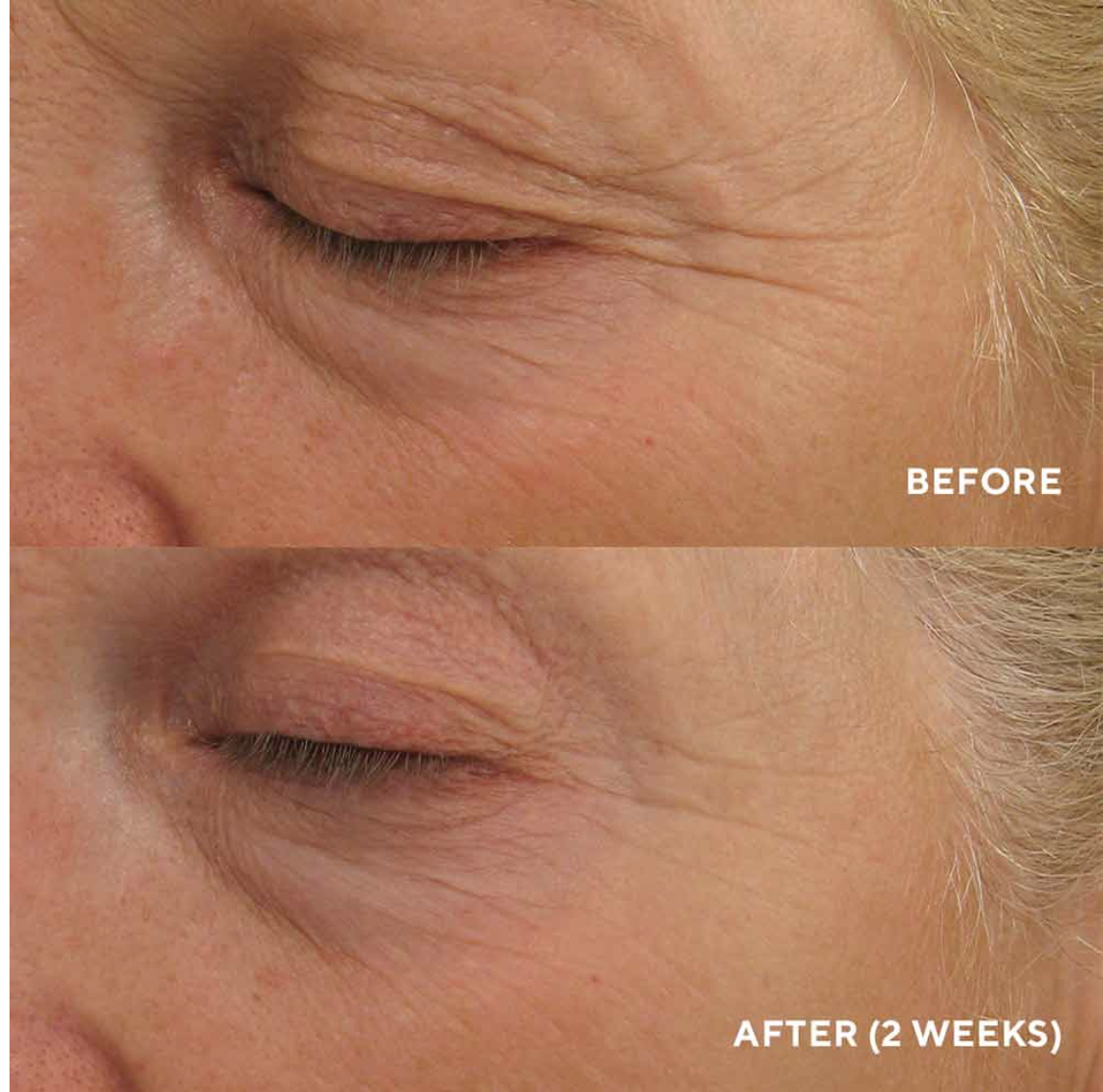 Eye Authority {Dark Circles, Puffiness, Fine Lines}